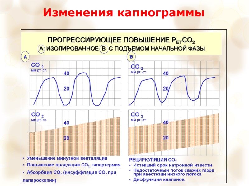 Изменения капнограммы